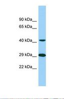 TTLL1 Antibody - Western blot of Human 721_B. TTLL1 antibody dilution 1.0 ug/ml.  This image was taken for the unconjugated form of this product. Other forms have not been tested.