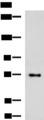 TTLL10 Antibody - Western blot analysis of HepG2 cell lysate  using TTLL10 Polyclonal Antibody at dilution of 1:850