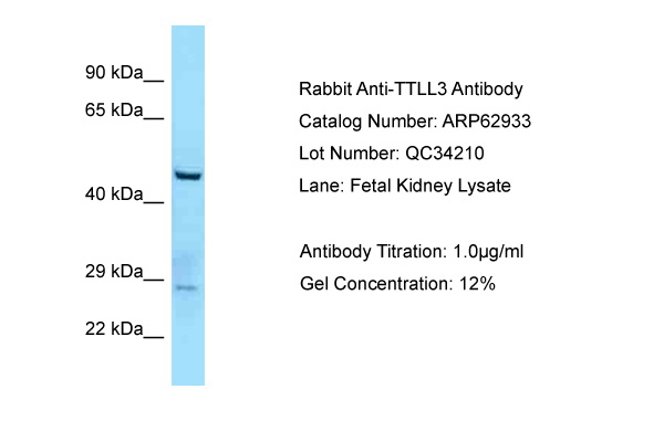 TTLL3 Antibody -  This image was taken for the unconjugated form of this product. Other forms have not been tested.