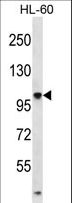 TTLL4 Antibody - TTLL4 Antibody western blot of HL-60 cell line lysates (35 ug/lane). The TTLL4 antibody detected the TTLL4 protein (arrow).
