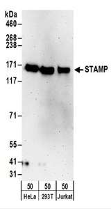 TTLL5 Antibody - Detection of Human STAMP by Western Blot. Samples: Whole cell lysate (50 ug) from HeLa, 293T, and Jurkat cells. Antibodies: Affinity purified rabbit anti-STAMP antibody used for WB at 0.4 ug/ml. Detection: Chemiluminescence with an exposure time of 3 minutes.
