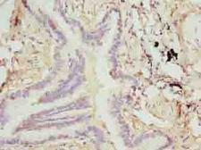 TTLL6 Antibody - Immunohistochemistry of paraffin-embedded human lung tissue using antibody at dilution of 1:100.