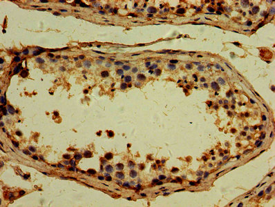 TTLL6 Antibody - IHC image of TTLL6 Antibody diluted at 1:500 and staining in paraffin-embedded human testis tissue performed on a Leica BondTM system. After dewaxing and hydration, antigen retrieval was mediated by high pressure in a citrate buffer (pH 6.0). Section was blocked with 10% normal goat serum 30min at RT. Then primary antibody (1% BSA) was incubated at 4°C overnight. The primary is detected by a biotinylated secondary antibody and visualized using an HRP conjugated SP system.
