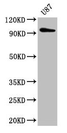 TTLL6 Antibody - Western Blot Positive WB detected in: U87 whole cell lysate All lanes: TTLL6 antibody at 5µg/ml Secondary Goat polyclonal to rabbit IgG at 1/50000 dilution Predicted band size: 97, 65 kDa Observed band size: 97 kDa