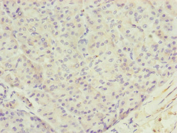 TTLL7 Antibody - Immunohistochemistry of paraffin-embedded human pancreatic tissue at dilution of 1:100