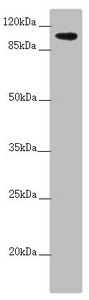 TTLL7 Antibody - Western blot All Lanes:TTLL7 antibody at 2.6 ug/ml+ A549 whole cell lysate Secondary Goat polyclonal to rabbit IgG at 1/10000 dilution Predicted band size: 103,78,93 kDa Observed band size: 103 kDa