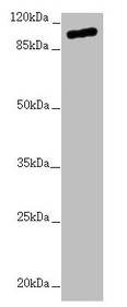 TTLL7 Antibody - Western blot All lanes: TTLL7 antibody at 2.04µg/ml + Hela whole cell lysate Secondary Goat polyclonal to rabbit IgG at 1/10000 dilution Predicted band size: 103, 78, 93 kDa Observed band size: 103 kDa