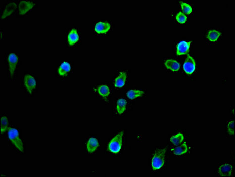 TTLL8 Antibody - Immunofluorescent analysis of Ntera-2 cells using TTLL8 Antibody at a dilution of 1:100 and Alexa Fluor 488-congugated AffiniPure Goat Anti-Rabbit IgG(H+L)