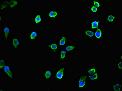 TTLL8 Antibody - Immunofluorescent analysis of Ntera-2 cells using TTLL8 Antibody at dilution of 1:100 and Alexa Fluor 488-congugated AffiniPure Goat Anti-Rabbit IgG(H+L)