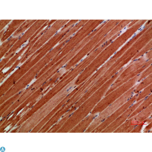 TTN / Titin Antibody - Immunohistochemical analysis of paraffin-embedded human-skeletal-muscle, antibody was diluted at 1:200.