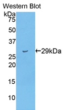 TTN / Titin Antibody - Western Blot; Sample: Recombinant protein.