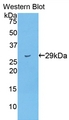 TTN / Titin Antibody - Western Blot; Sample: Recombinant protein.