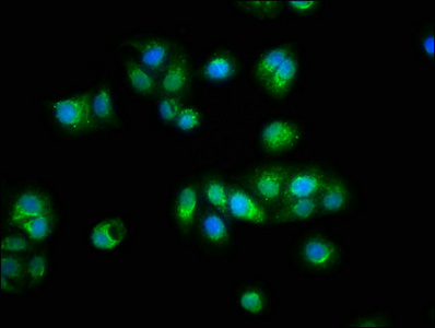 TTN / Titin Antibody - Immunofluorescence staining of HepG2 cells with TTN Antibody at 1:100, counter-stained with DAPI. The cells were fixed in 4% formaldehyde, permeabilized using 0.2% Triton X-100 and blocked in 10% normal Goat Serum. The cells were then incubated with the antibody overnight at 4°C. The secondary antibody was Alexa Fluor 488-congugated AffiniPure Goat Anti-Rabbit IgG(H+L).
