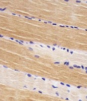 TTN / Titin Antibody - Antibody staining TTN in human skeletal muscle sections by Immunohistochemistry (IHC-P - paraformaldehyde-fixed, paraffin-embedded sections). Tissue was fixed with formaldehyde and blocked with 3% BSA for 0. 5 hour at room temperature; antigen retrieval was by heat mediation with a citrate buffer (pH 6). Samples were incubated with primary antibody (1:25) for 1 hours at 37°C. A undiluted biotinylated goat polyvalent antibody was used as the secondary antibody.