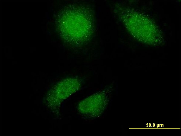 TTN / Titin Antibody - Immunofluorescence of monoclonal antibody to TTN on HeLa cell. [antibody concentration 10 ug/ml].