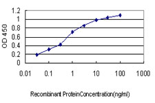TTN / Titin Antibody - Detection limit for recombinant GST tagged TTN is approximately 0.03 ng/ml as a capture antibody.