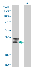 TTN / Titin Antibody - Western blot of TTN expression in transfected 293T cell line by TTN monoclonal antibody (M09), clone 6H5.