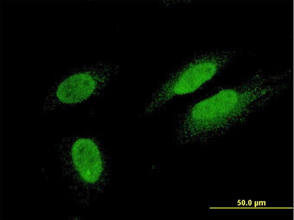 TTN / Titin Antibody - Immunofluorescence of monoclonal antibody to TTN on HeLa cell. [antibody concentration 10 ug/ml].