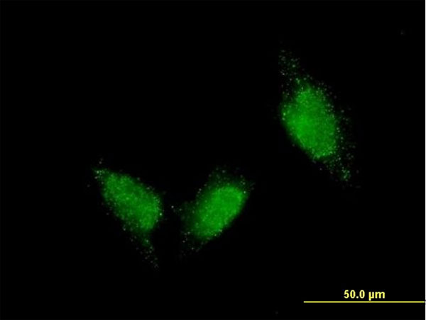 TTN / Titin Antibody - Immunofluorescence of monoclonal antibody to TTN on HeLa cell. [antibody concentration 10 ug/ml].