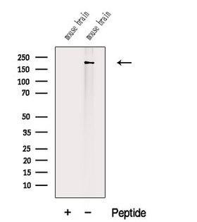 TTN / Titin Antibody - Western blot analysis of extracts of mouse brain tissue using TITIN antibody. The lane on the left was treated with blocking peptide.