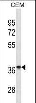 TTPA Antibody - TTPA Antibody western blot of CEM cell line lysates (35 ug/lane). The TTPA antibody detected the TTPA protein (arrow).