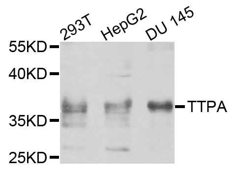 TTPA Antibody - Western blot analysis of extracts of various cells.