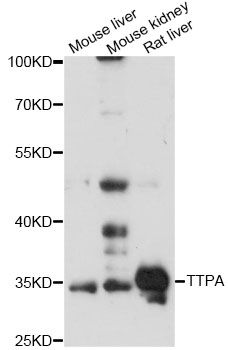 TTPA Antibody - Western blot analysis of extracts of various cell lines, using TTPA antibody at 1:3000 dilution. The secondary antibody used was an HRP Goat Anti-Rabbit IgG (H+L) at 1:10000 dilution. Lysates were loaded 25ug per lane and 3% nonfat dry milk in TBST was used for blocking. An ECL Kit was used for detection and the exposure time was 30s.