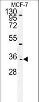 TTPAL / C20orf121 Antibody - Western blot of TTPAL Antibody in MCF-7cell line lysates (35 ug/lane). TTPAL (arrow) was detected using the purified antibody.