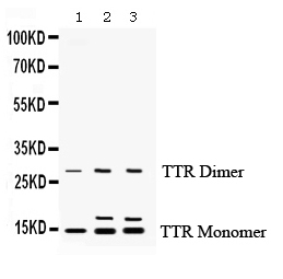 TTR / Transthyretin Antibody - anti-Prealbumin Picoband antibody Western blotting All lanes: Anti Prealbumin at 0.5ug/ml Lane 1: Rat Liver Tissue Lysate at 50ug Lane 2: Mouse Liver Tissue Lysate at 50ug Lane 3: Mouse Testis Tissue Lysate at 50ug Predicted bind size: 14KD, 28KD, 55KD Observed bind size: 14KD, 28KD