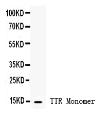 TTR / Transthyretin Antibody - anti-Prealbumin Picoband antibody Western blotting All lanes: Anti Prealbumin at 0.5ug/ml WB: Human Blood Lysate at 50ug Predicted bind size: 14KD Observed bind size: 14KD