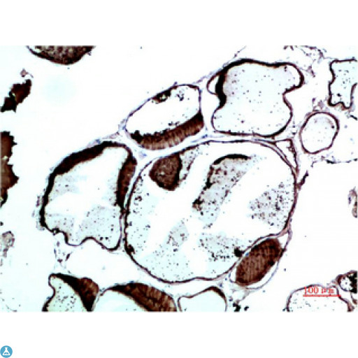 TTR / Transthyretin Antibody - Immunohistochemical analysis of paraffin-embedded Human Thyroid Tissue using TTR Mouse mAb diluted at 1:200.