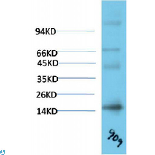 TTR / Transthyretin Antibody - Western blot analysis of Human Serum using TTR Mouse mAb diluted at 1:2000.