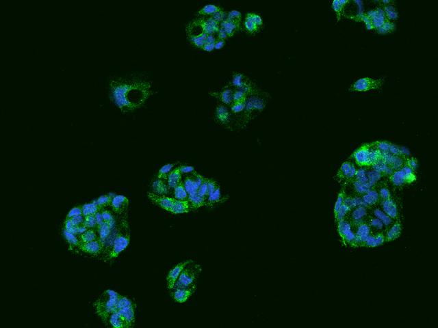 TTR / Transthyretin Antibody - Immunofluorescence staining of TTR in HepG2 cells. Cells were fixed with 4% PFA, permeabilzed with 0.1% Triton X-100 in PBS, blocked with 10% serum, and incubated with rabbit anti-Human TTR polyclonal antibody (dilution ratio 1:200) at 4°C overnight. Then cells were stained with the Alexa Fluor 488-conjugated Goat Anti-rabbit IgG secondary antibody (green) and counterstained with DAPI (blue). Positive staining was localized to Cytoplasm.