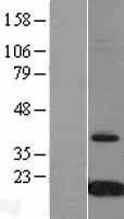 TTR / Transthyretin Protein - Western validation with an anti-DDK antibody * L: Control HEK293 lysate R: Over-expression lysate