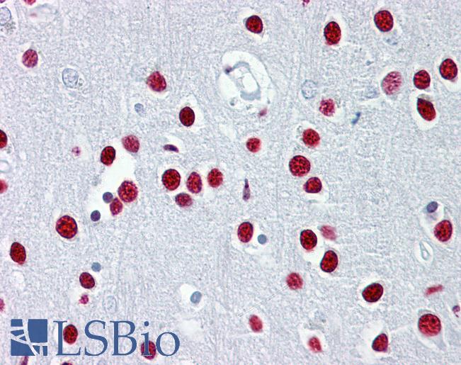 TUB / Tubby Antibody - Anti-TUB antibody IHC of human brain, cortex. Immunohistochemistry of formalin-fixed, paraffin-embedded tissue after heat-induced antigen retrieval. Antibody concentration 5 ug/ml.  This image was taken for the unconjugated form of this product. Other forms have not been tested.