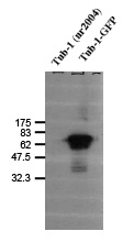 TUB / Tubby Antibody - Detection of tub-1 (GFP complex) using Tub-1 Antibody - Neuronal Marker. Tub-1 (nr2004) was used as a negative control.