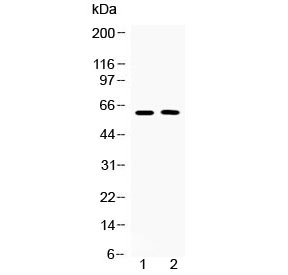 TUB / Tubby Antibody - Western blot testing of human 1) COLO320 and 2) MCF7 cell lysate with Tubby antibody at 0.5ug/ml. Predicted molecular weight ~56/62 kDa (isoforms 1/2).