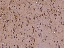 TUB / Tubby Antibody - Immunochemical staining of human TUB in human brain with rabbit polyclonal antibody at 1:300 dilution, formalin-fixed paraffin embedded sections.