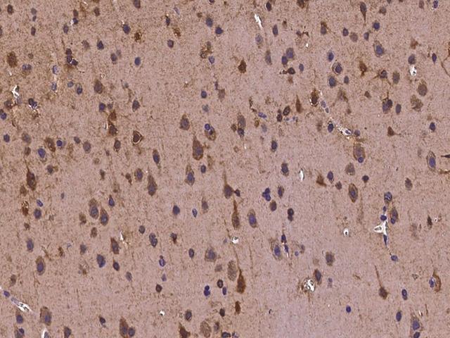 TUB / Tubby Antibody - Immunochemical staining of human TUB in human brain with rabbit polyclonal antibody at 1:300 dilution, formalin-fixed paraffin embedded sections.
