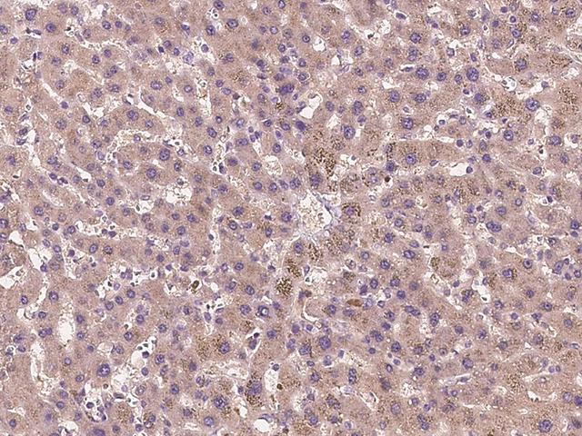 TUB / Tubby Antibody - Immunochemical staining of human TUB in human liver with rabbit polyclonal antibody at 1:300 dilution, formalin-fixed paraffin embedded sections.