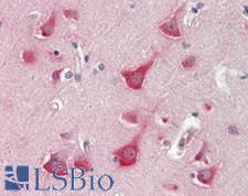 TUB / Tubby Antibody - Human Brain, Cortex: Formalin-Fixed, Paraffin-Embedded (FFPE).  This image was taken for the unconjugated form of this product. Other forms have not been tested.