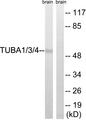 TUBA1+3+4 Antibody - Western blot analysis of extracts from Rat brain cells, using TUBA1/3/4 (Ab-272) antibody.