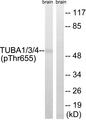 TUBA1+3+4 Antibody - Western blot analysis of extracts from Rat brain cells, using TUBA1/3/4 (Phospho-Tyr272) antibody.