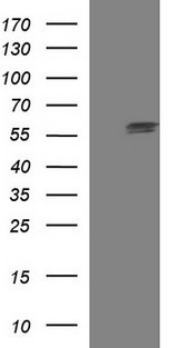 TUBA1A / Tubulin Alpha 1a Antibody - HEK293T cells were transfected with the pCMV6-ENTRY control (Left lane) or pCMV6-ENTRY TUBA1A (Right lane) cDNA for 48 hrs and lysed. Equivalent amounts of cell lysates (5 ug per lane) were separated by SDS-PAGE and immunoblotted with anti-TUBA1A.