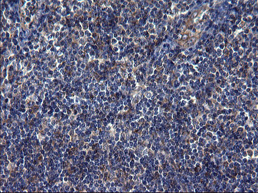 TUBA1A / Tubulin Alpha 1a Antibody - IHC of paraffin-embedded Human lymph node tissue using anti-TUBA1A mouse monoclonal antibody. (Heat-induced epitope retrieval by 1 mM EDTA in 10mM Tris, pH8.5, 120°C for 3min).