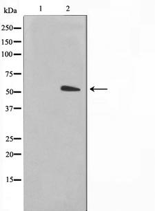 TUBA1A / Tubulin Alpha 1a Antibody - Western blot analysis on NIH-3T3 cell lysates using Tubulin alpha antibody. The lane on the left is treated with the antigen-specific peptide.