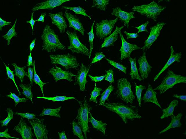 TUBA1A / Tubulin Alpha 1a Antibody - Immunofluorescence staining of Alpha-Tubulin in HeLa cells. Cells were fixed with 4% PFA, permeabilzed with 0.1% Triton X-100 in PBS, blocked with 10% serum, and incubated with rabbit anti-Human Alpha-Tubulin polyclonal antibody (dilution ratio 1:200) at 4°C overnight. Then cells were stained with the Alexa Fluor 488-conjugated Goat Anti-rabbit IgG secondary antibody (green) and counterstained with DAPI (blue). Positive staining was localized to Cytoplasm.