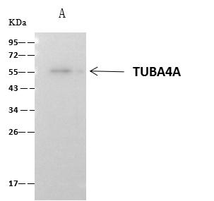 TUBA1A / Tubulin Alpha 1a Antibody - Alpha-Tubulin was immunoprecipitated using: Lane A: 0.5 mg Hela Whole Cell Lysate. 4 uL anti-Alpha-Tubulin rabbit polyclonal antibody and 60 ug of Immunomagnetic beads Protein A/G. Primary antibody: Anti-Alpha-Tubulin rabbit polyclonal antibody, at 1:100 dilution. Secondary antibody: Clean-Blot IP Detection Reagent (HRP) at 1:1000 dilution. Developed using the ECL technique. Performed under reducing conditions. Predicted band size: 55 kDa. Observed band size: 55 kDa.