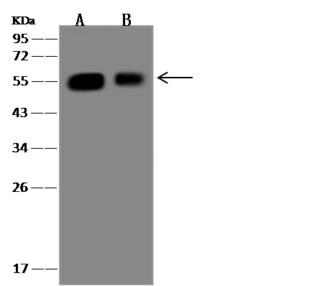 TUBA1A / Tubulin Alpha 1a Antibody - Anti-Alpha-Tubulin rabbit polyclonal antibody at 1:500 dilution. Lane A: Jurkat Whole Cell Lysate. Lane B: HeLa Whole Cell Lysate. Lysates/proteins at 30 ug per lane. Secondary: Goat Anti-Rabbit IgG (H+L)/HRP at 1/10000 dilution. Developed using the ECL technique. Performed under reducing conditions. Predicted band size: 50 kDa. Observed band size: 50 kDa.