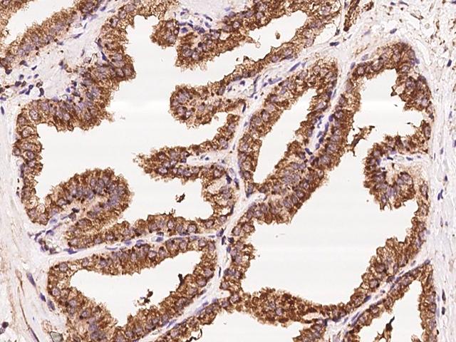 TUBA1A / Tubulin Alpha 1a Antibody - Immunochemical staining of human Alpha-Tubulin in human prostate with rabbit polyclonal antibody at 1:1000 dilution, formalin-fixed paraffin embedded sections.